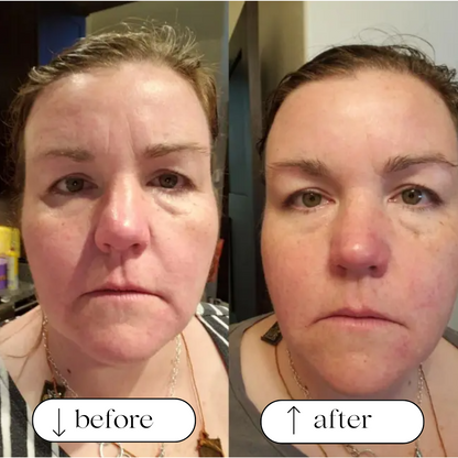 Age-Reversing Whipped Tallow Cream